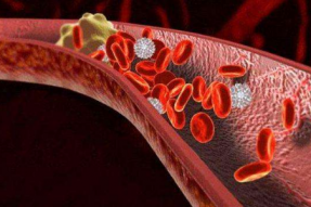 30歲后要多吃這12種清理血管的特效素食